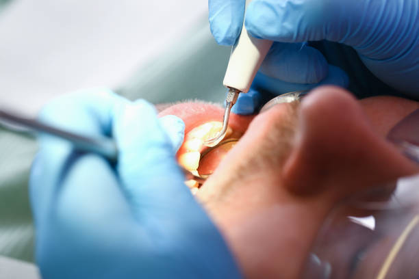 Best Emergency Dental Services for Seniors in The Hills, TX