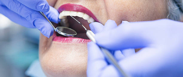 Best Emergency Dental Extractions in The Hills, TX