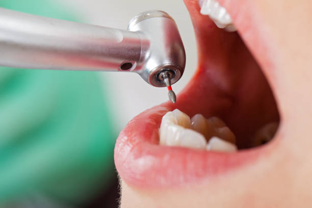 Best Holiday Emergency Dentist in The Hills, TX